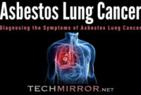 Asbestos Lung Cancer