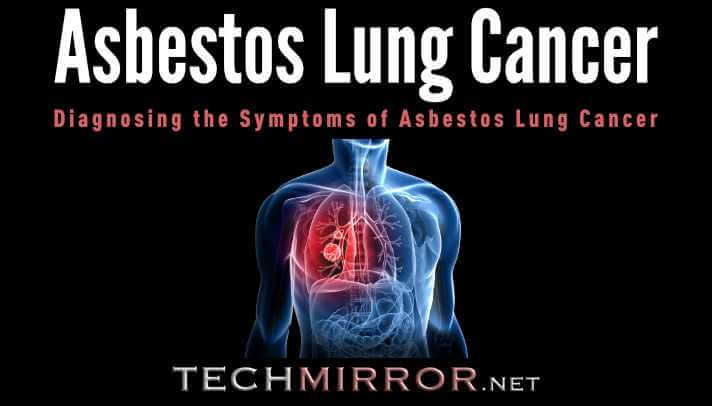 Asbestos Lung Cancer [Full Information] - TechMirror